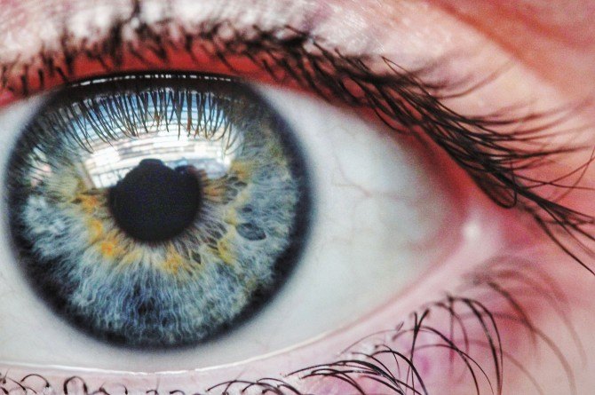 myopia in children