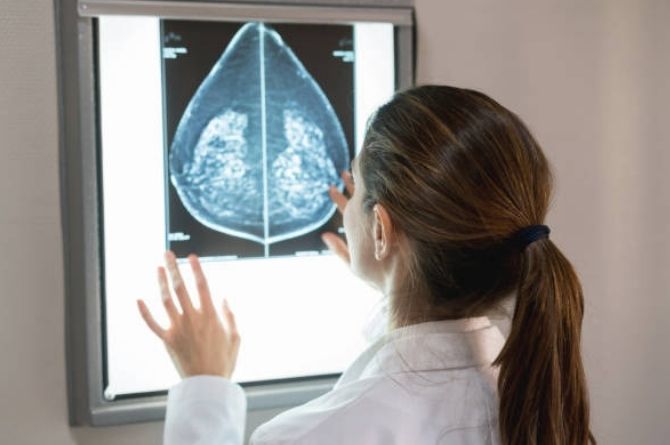 Risk Of Breast Cancer By Age