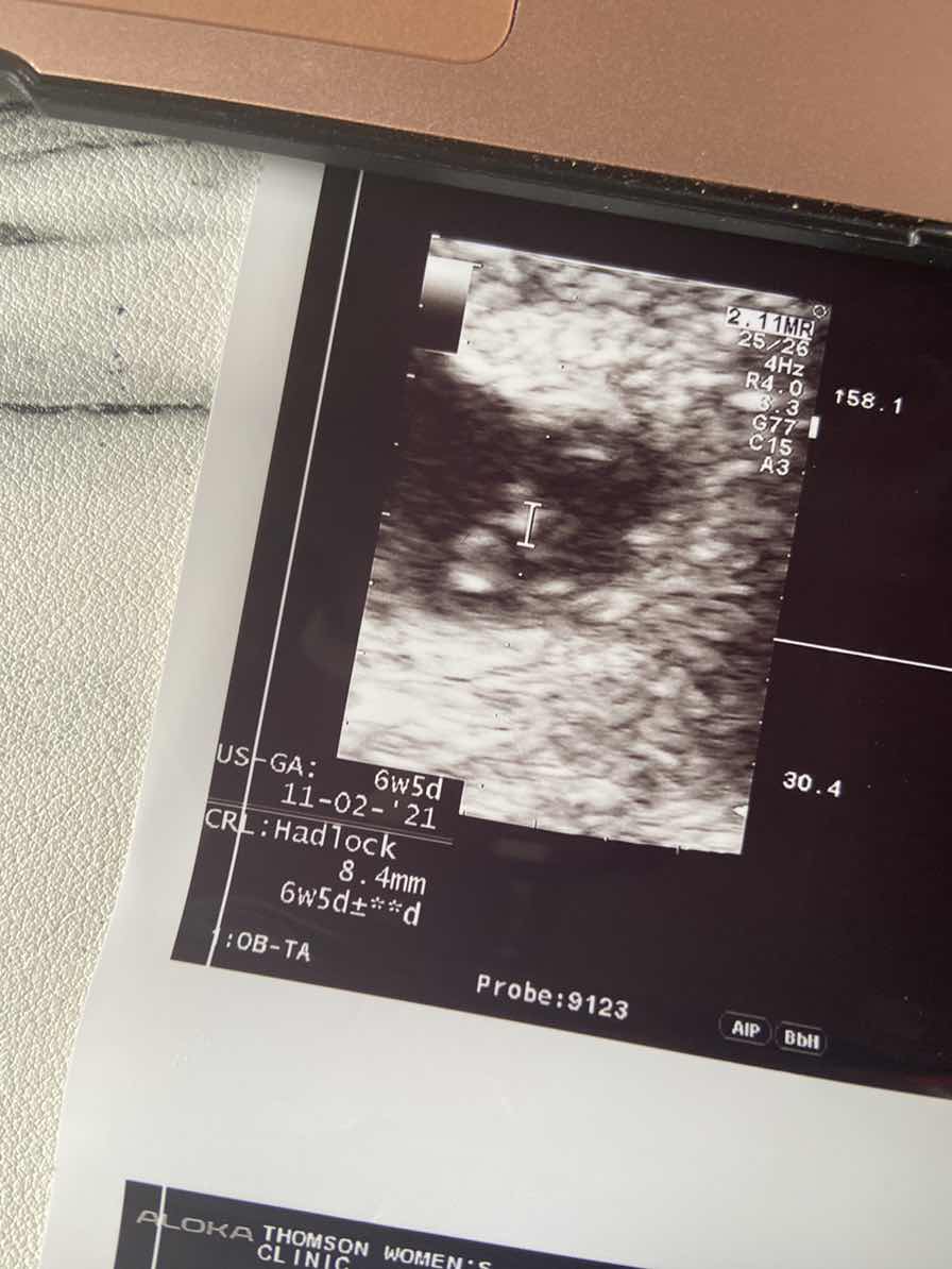 6 weeks pregnant ultrasound nothing but showed nothing but yolk sac