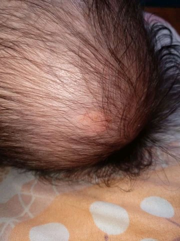 3 Months Old