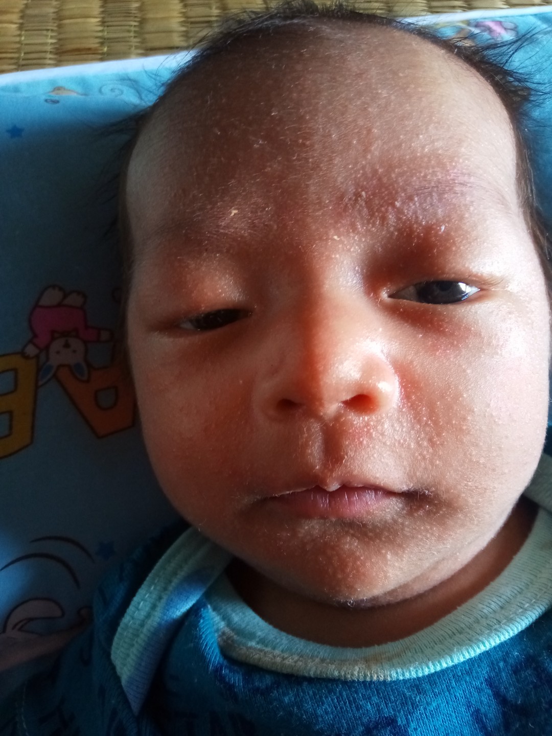 น้องมีพดขึ้นที่หน้าและใบหูค่ะ