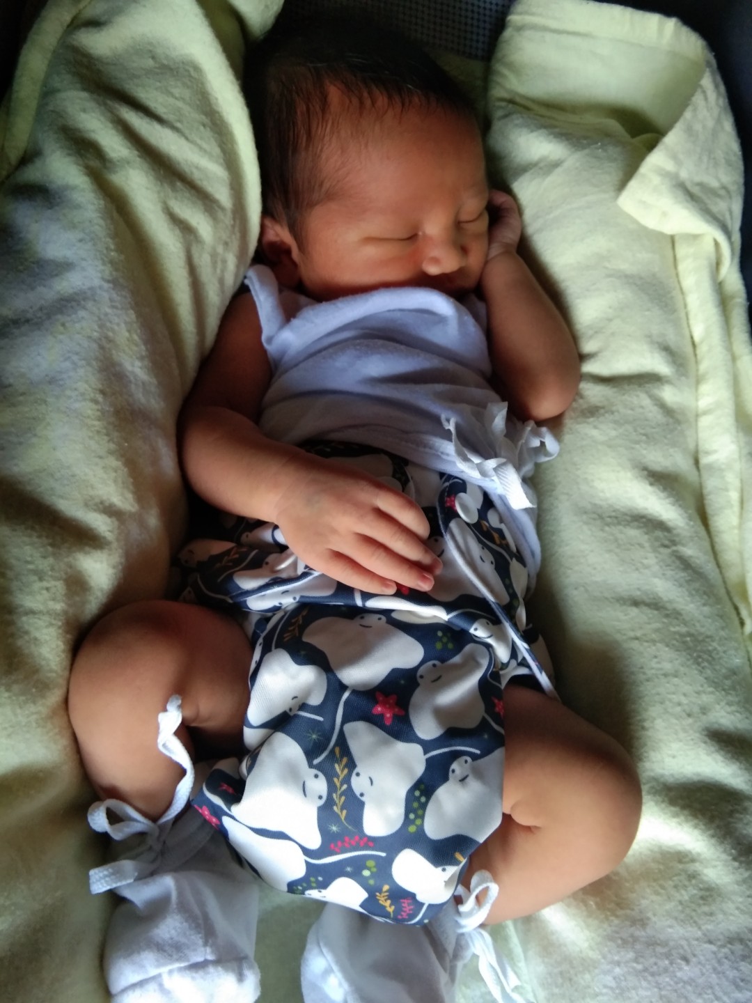 My birthing story -mej mahaba haha
