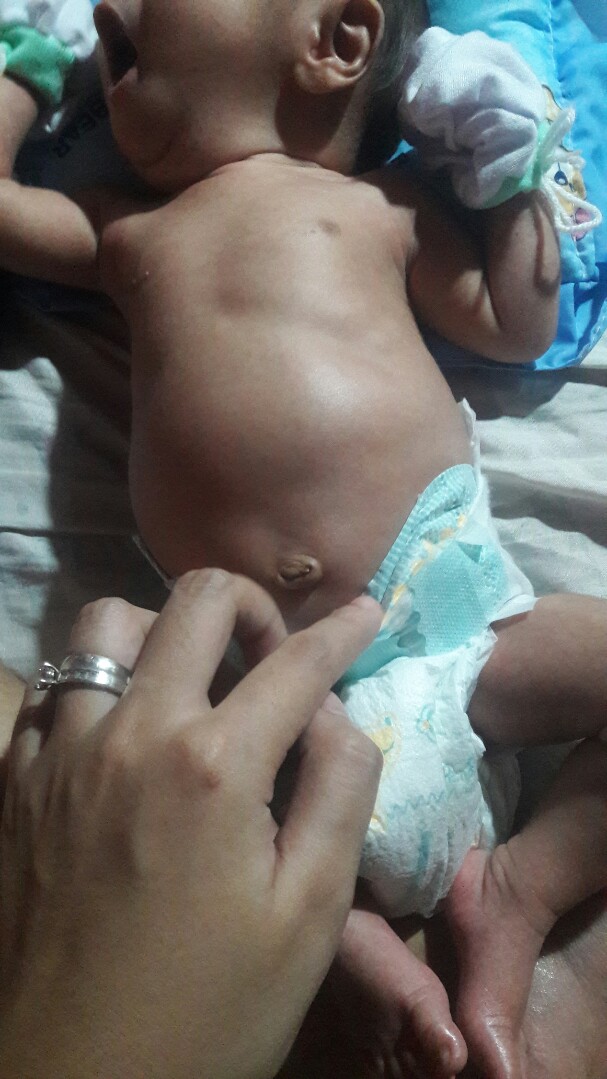 newborn tummy