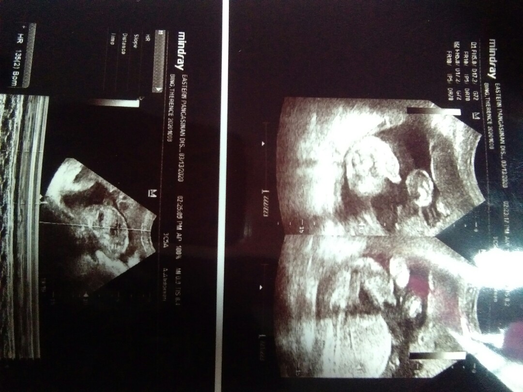 32weeks