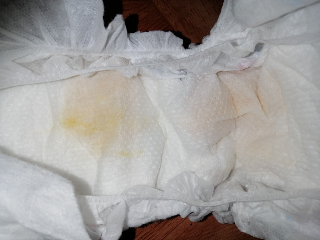 URINE