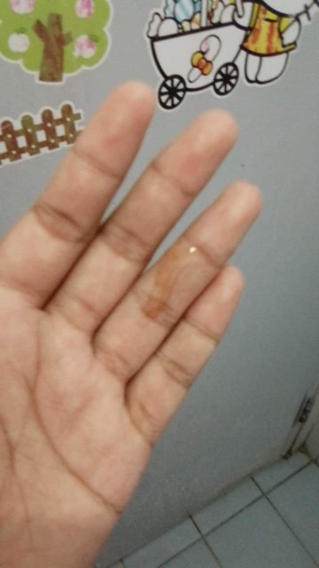 มีมูกแบบนี้ไหล