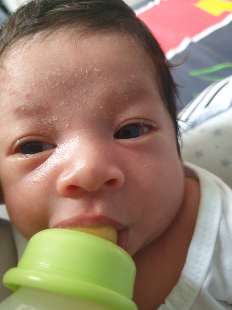 may mapula sa mata ng baby ko