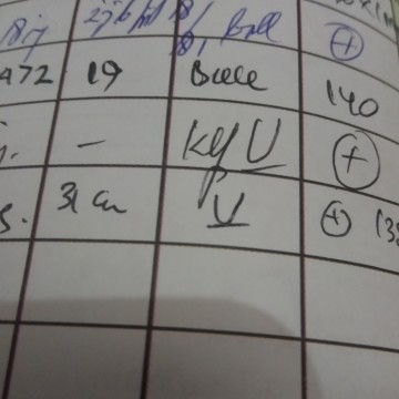 posisi janin