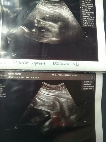 scan girl
