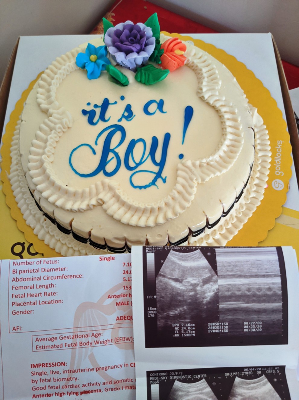 Gender Reveal@Week 27 Day 6
