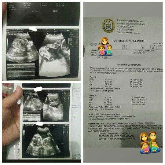 Twin Babies. Same experience?