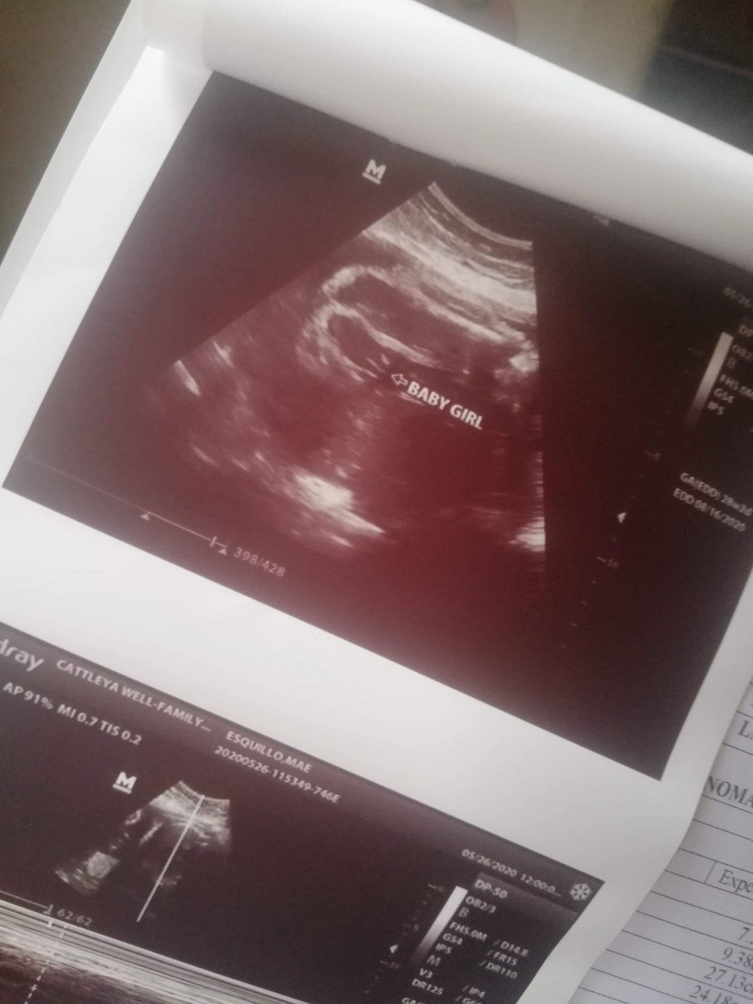 update : May 26,2020(28 weeks day 2) .. and its a baby girl ! 