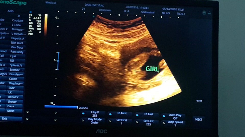 IT'S A GIRL