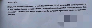 Confirming Result of BPS