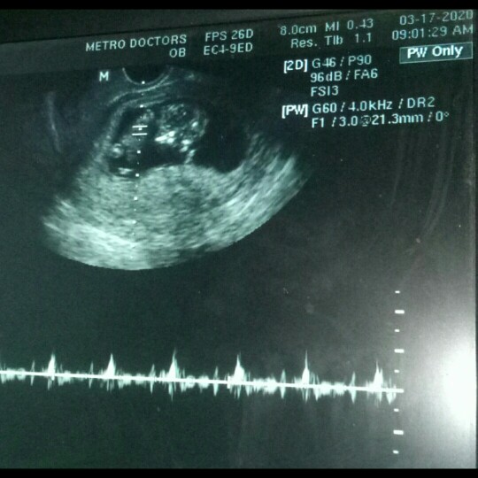 OB (transv ultrasound results)