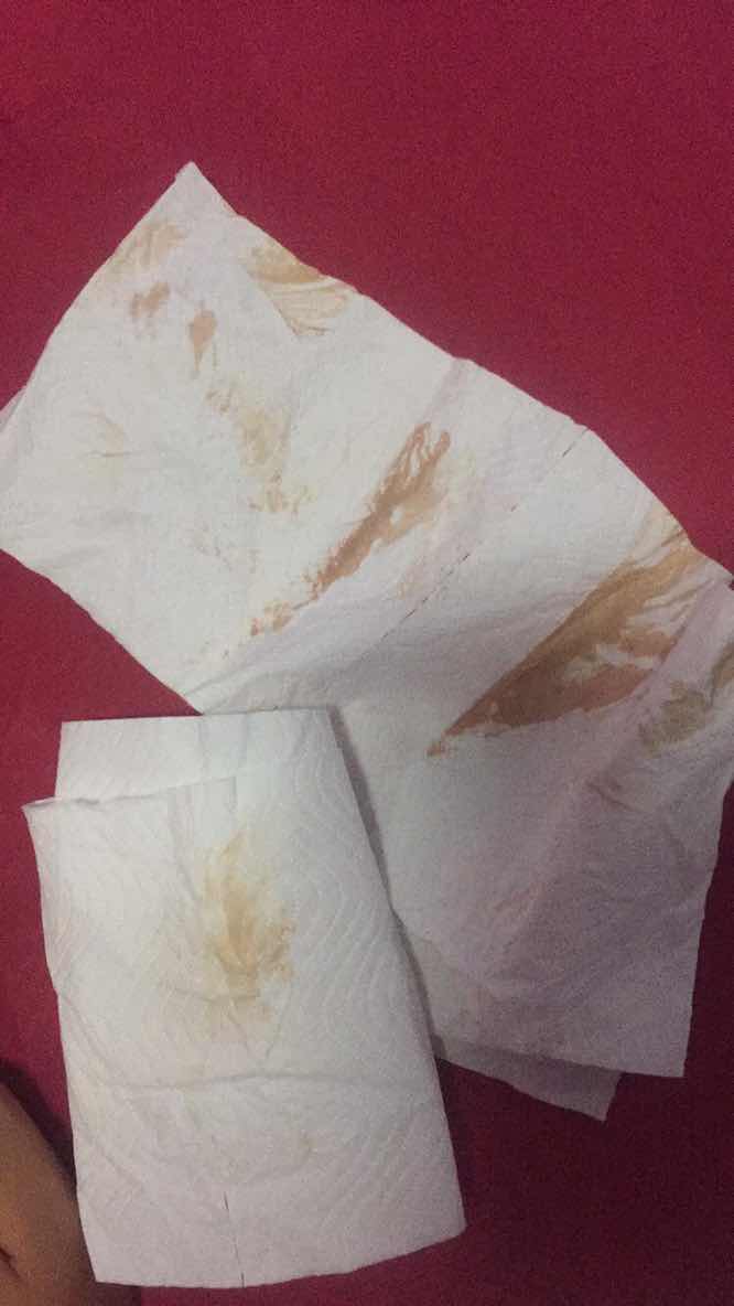 เป็นอะไรต่อตัวเล็กมั้ยคะ
