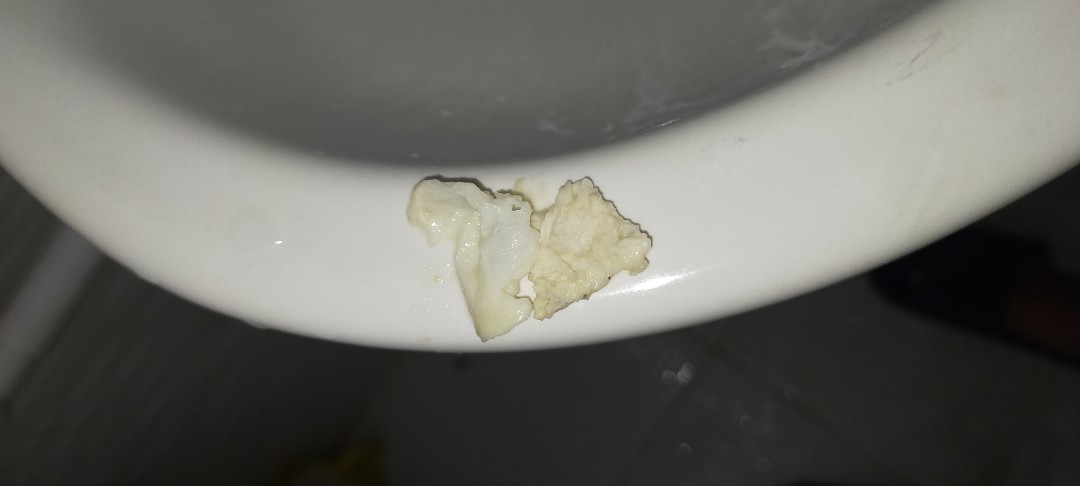 Vaginal Discharge ba eto? 