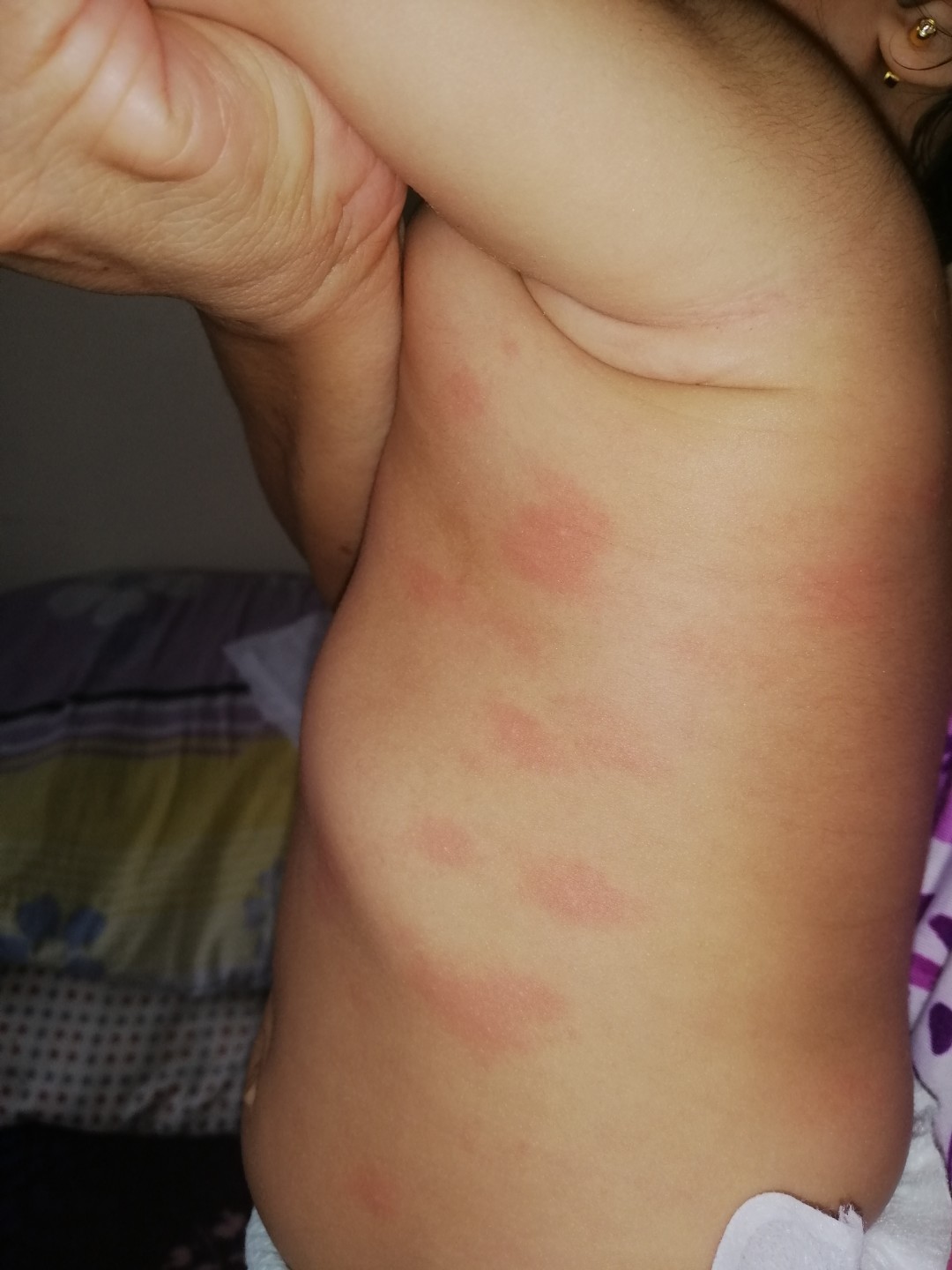 Rashes, Butlig, Pantal