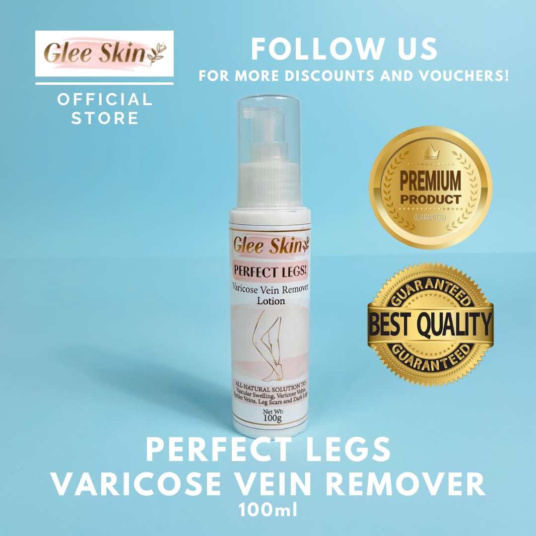 Glee Skin Varicose Veins Remover Cream | Mabisang Gamot sa Varicose Veins
