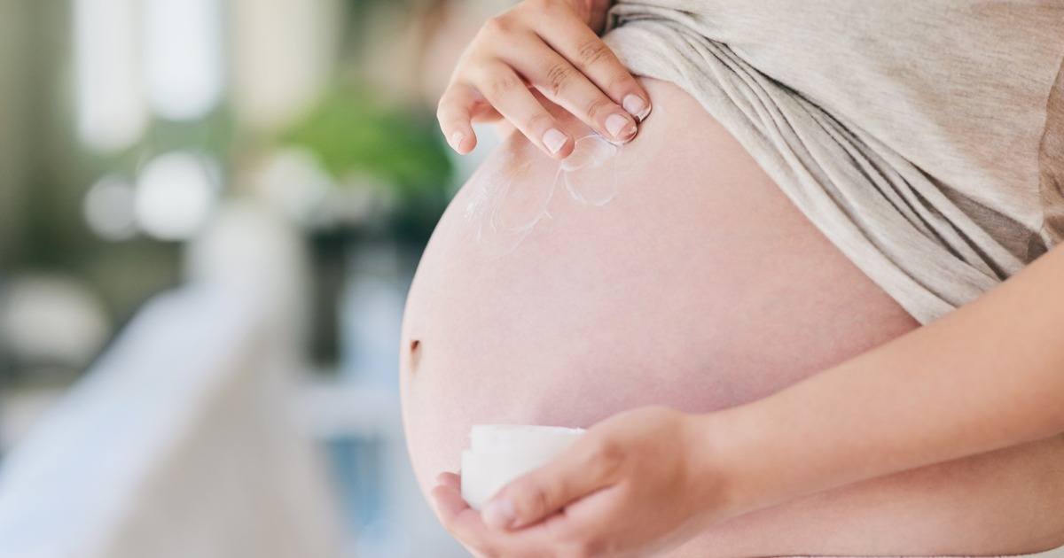 Top Stretch Mark Creams in Singapore to Improve Skin During Pregnancy