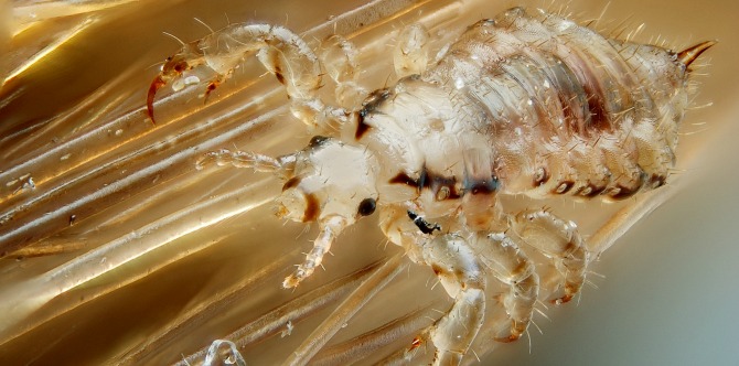 Lice In Hair How To Get Rid Of Head Lice In Your Child S Hair