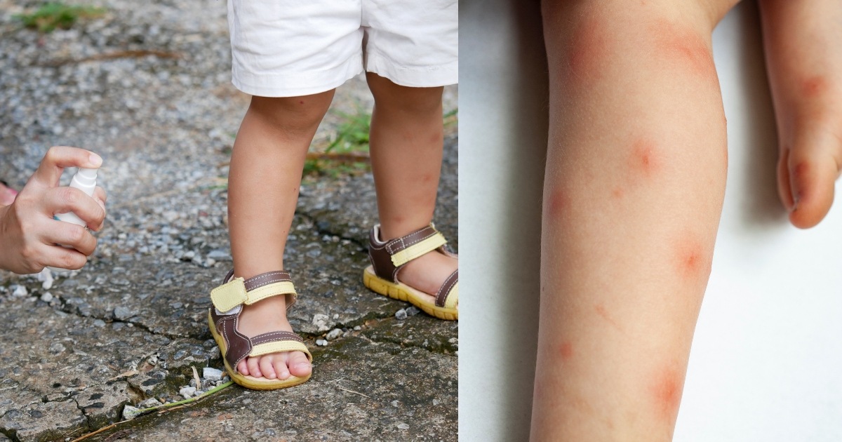 Best Mosquito Repellent for Babies and Kids: Everything You Need to Know
