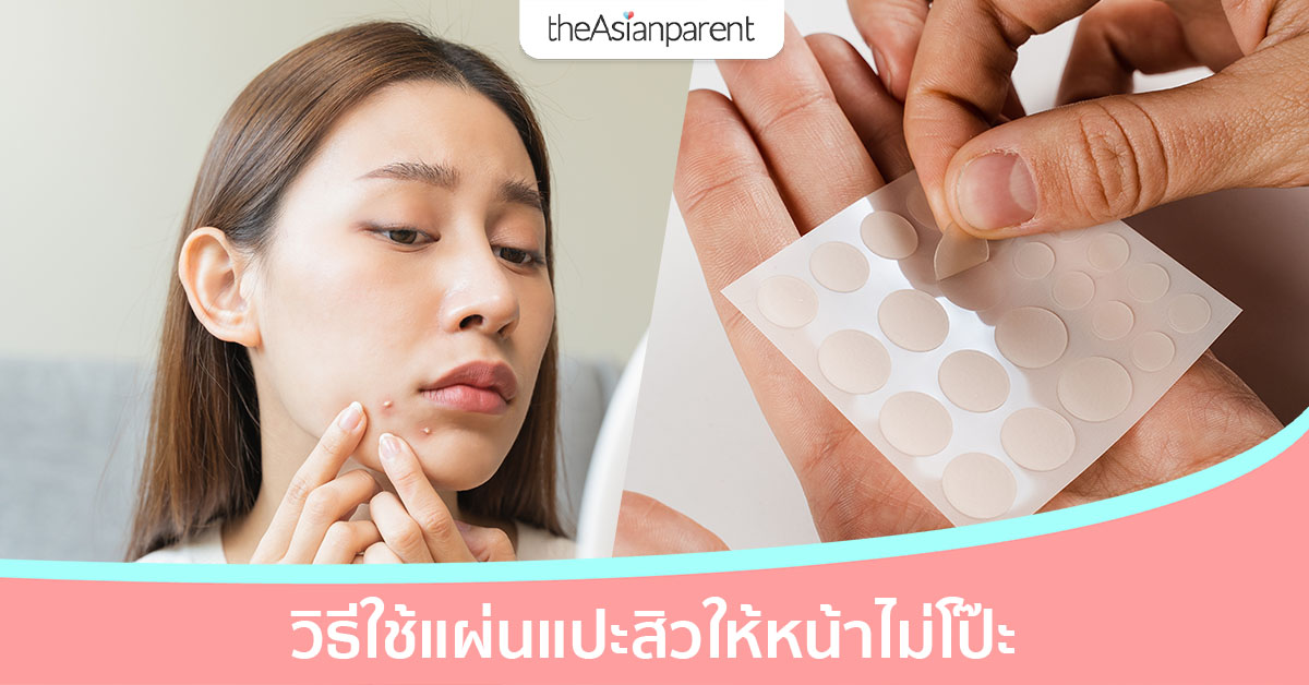 แผ่นแปะสิว ใช้ยังไง? วิธีใช้แผ่นแปะสิวให้เนียน แต่หน้ายังเป๊ะ!