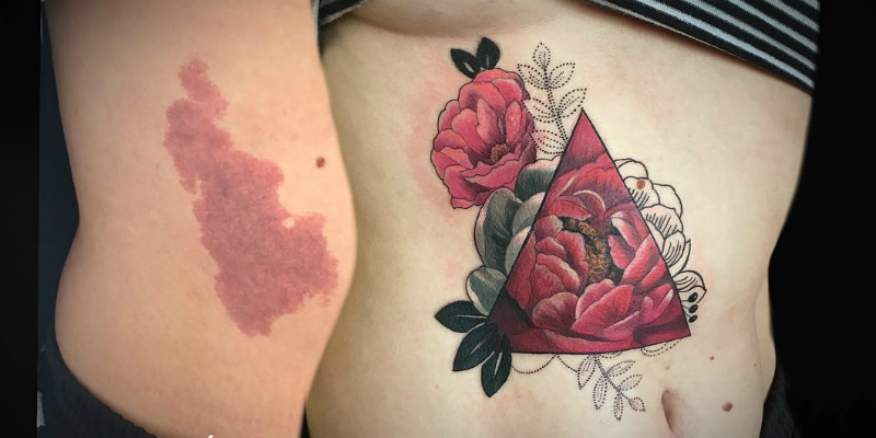 Tato Unik Ini Sulap Bekas Luka Jadi Karya Seni