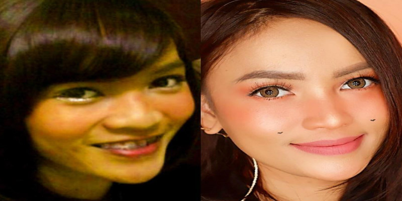 Lihat Perubahan Wajah Artis Indonesia di 10 Year Challenge, Seru Deh!