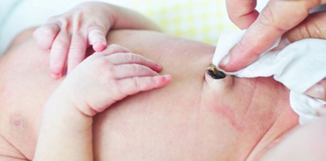 Cara Yang Betul Menjaga Baki Tali Pusat Bayi Jangan Sampai Kemerah Merahan Ya Ibu