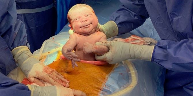 Proses Bersalin Normal Tiada Apa Yang Normal Tentang Proses Ini