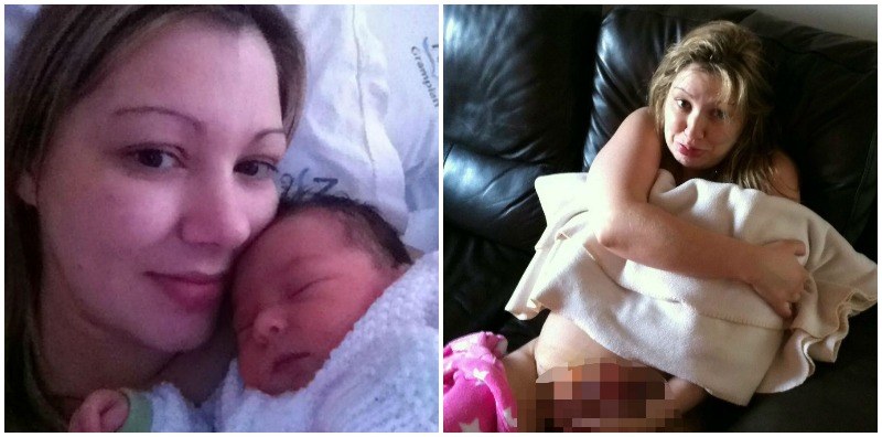 Jahitan Bersalin Terbuka 8 Tips Menjaga Luka Bersalin Ceaser