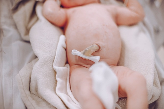 Tanda Bayi Terlilit Tali Pusat Apa Yang Anda Patut Tahu