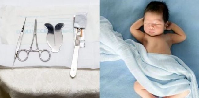 Sunat Bayi Lelaki Usia 2 Bulan Ibu Ini Kongsi Pengalaman